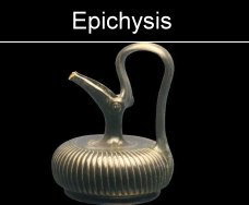 Epichysis